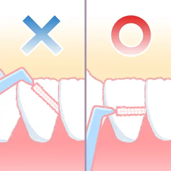 歯間ブラシ