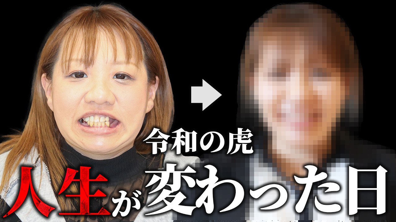 All-on-4専門サイト